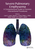 Severe Pulmonary Emphysema:: A Comprehensive Guide to Precision Interventional Procedures