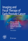 Imaging and Focal Therapy of Early Prostate Cancer