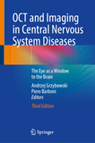 OCT and Imaging in Central Nervous System Diseases: The Eye as a Window to the Brain