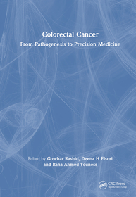 Colorectal Cancer: From Pathogenesis to Precision Medicine