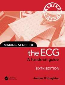 Making Sense of the ECG: A Hands-On Guide