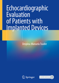 Echocardiographic Evaluation of Patients with Implanted Devices