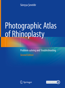 Photographic Atlas of Rhinoplasty: Problem-solving and Troubleshooting