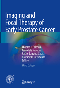 Imaging and Focal Therapy of Early Prostate Cancer