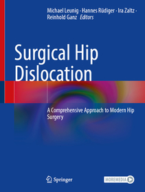 Surgical Hip Dislocation: A Comprehensive Approach to Modern Hip Surgery