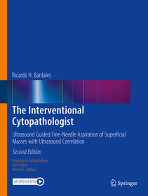 The Interventional Cytopathologist: Ultrasound Guided Fine-Needle Aspiration of Superficial Masses with Ultrasound Correlation