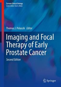 Imaging and Focal Therapy of Early Prostate Cancer